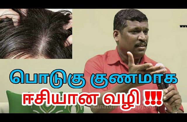 பொடுகு குணமாக இதை செய்யுங்க | Dandruff treatment by Healer baskar – 2