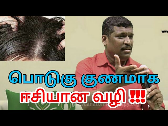 பொடுகு குணமாக இதை செய்யுங்க | Dandruff treatment by Healer baskar – 2