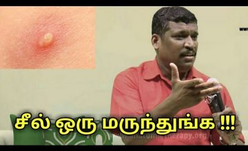 சீல் பிடித்தால் நல்லதுங்க | Healer baskar