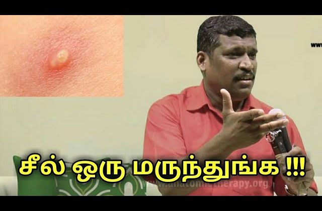 சீல் பிடித்தால் நல்லதுங்க | Healer baskar