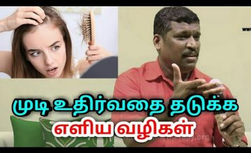 முடி உதிர்வதை தடுக்க எளிய வழி | Hair fall solution by Healer baskar
