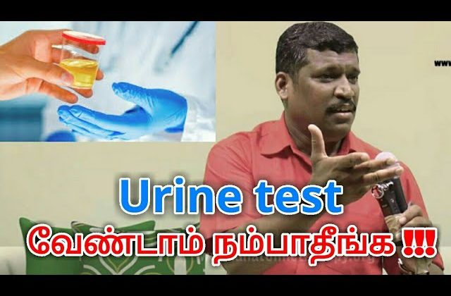 Urine test பண்ணாதீங்க | Healer baskar speech on Urine test danger