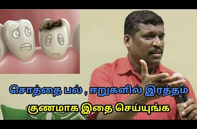 சொத்தை பல் குணமாக இதை செய்யுங்க | Treatment for Tooth decay by Healer baskar