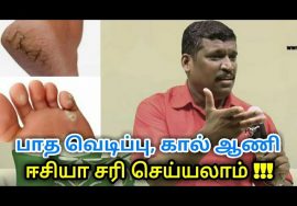 பாத வெடிப்பு,கால் ஆணி குணமாக | Foot cracks and Toe nail treatment by Healer Baskar