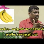 மஞ்சள் காமாலை-க்கு எளிய வைத்தியம் | Jaundice treatment in tamil by Healer Baskar sir