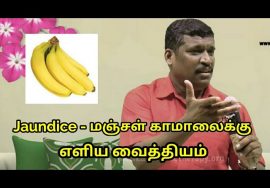 மஞ்சள் காமாலை-க்கு எளிய வைத்தியம் | Jaundice treatment in tamil by Healer Baskar sir