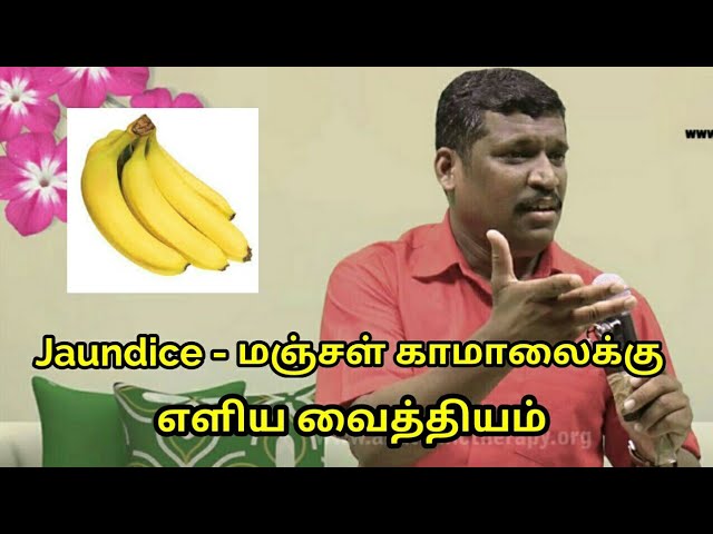 மஞ்சள் காமாலை-க்கு எளிய வைத்தியம் | Jaundice treatment in tamil by Healer Baskar sir
