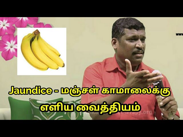 மஞ்சள் காமாலை-க்கு எளிய வைத்தியம் | Jaundice treatment in tamil by Healer Baskar sir