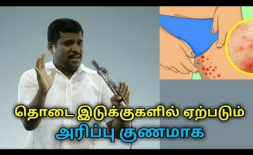 தொடை இடுக்குகளில் ஏற்படும் அரிப்பு குணமாக | Healer baskar speech on thigh itching treatment