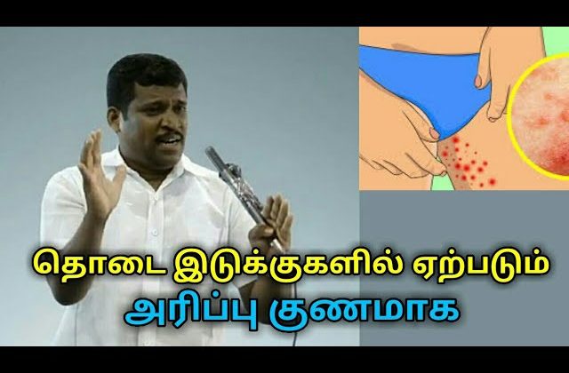 தொடை இடுக்குகளில் ஏற்படும் அரிப்பு குணமாக | Healer baskar speech on thigh itching treatment