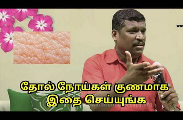 தோல் நோய்கள் குணமாக இதை செய்யுங்க | Skin disease treatment by Healer Baskar