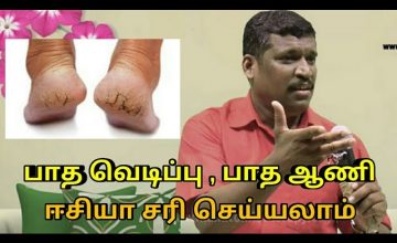 பாத வெடிப்பு மற்றும் ஆணியை ஈசியா சரி செய்யலாம் | Healer baskar speech on foot cracks and toe nail