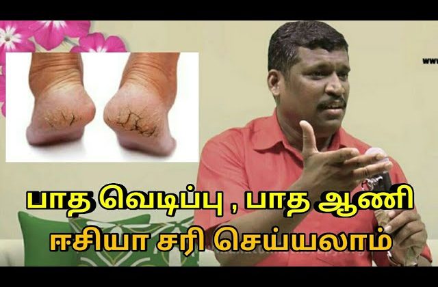 பாத வெடிப்பு மற்றும் ஆணியை ஈசியா சரி செய்யலாம் | Healer baskar speech on foot cracks and toe nail