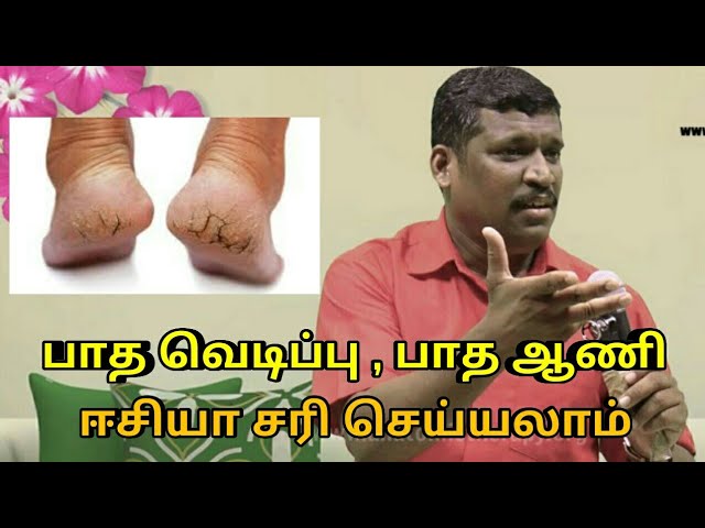 பாத வெடிப்பு மற்றும் ஆணியை ஈசியா சரி செய்யலாம் | Healer baskar speech on foot cracks and toe nail
