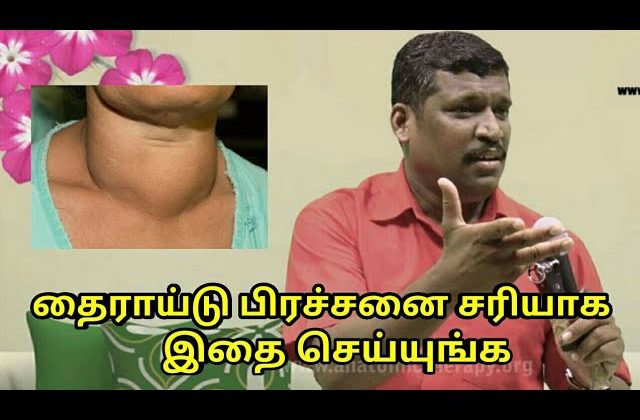 தைராய்டு பிரச்சனை குணமாக இதை செய்யுங்க | Thyroid treatment by Healer Baskar Sir