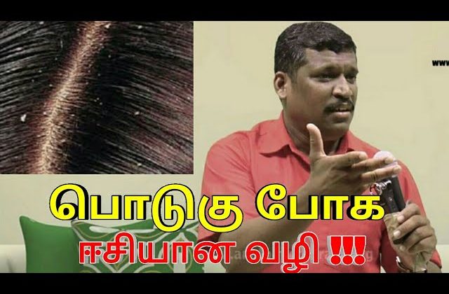 பொடுகு குணமாக இதை செய்யுங்க | Dandruff treatment by Healer baskar