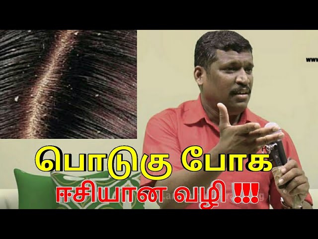 பொடுகு குணமாக இதை செய்யுங்க | Dandruff treatment by Healer baskar