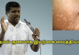 தேமல் குணமாக வீட்டு மருத்துவம் | Healer Baskar speech on skin patch removal tips