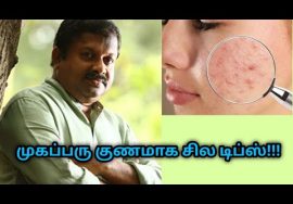 முகப்பரு குணமாக சில டிப்ஸ் | Dr.Sivaraman speech on home remedy for pimples