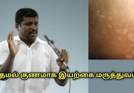 தேமல் குணமாக இயற்கை மருத்துவம் | Healer Baskar speech on themal treatment