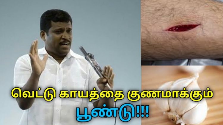 வெட்டு காயத்தை குணமாக்க வீட்டு வைத்தியம் | Healer Baskar speech on home remedy for wound
