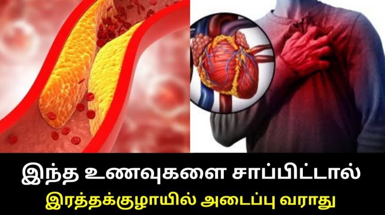 இருதயத்தில் ஏற்படும் அடைப்பை தடுக்கும் உணவுகள் |  Remedy for Blood vessel block