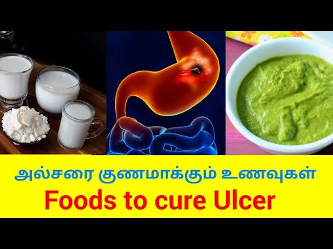 வயிற்றுப்புண்ணை குணமாக்கும் உணவுகள் | Foods to cure Ulcer | Home remedy for ulcer